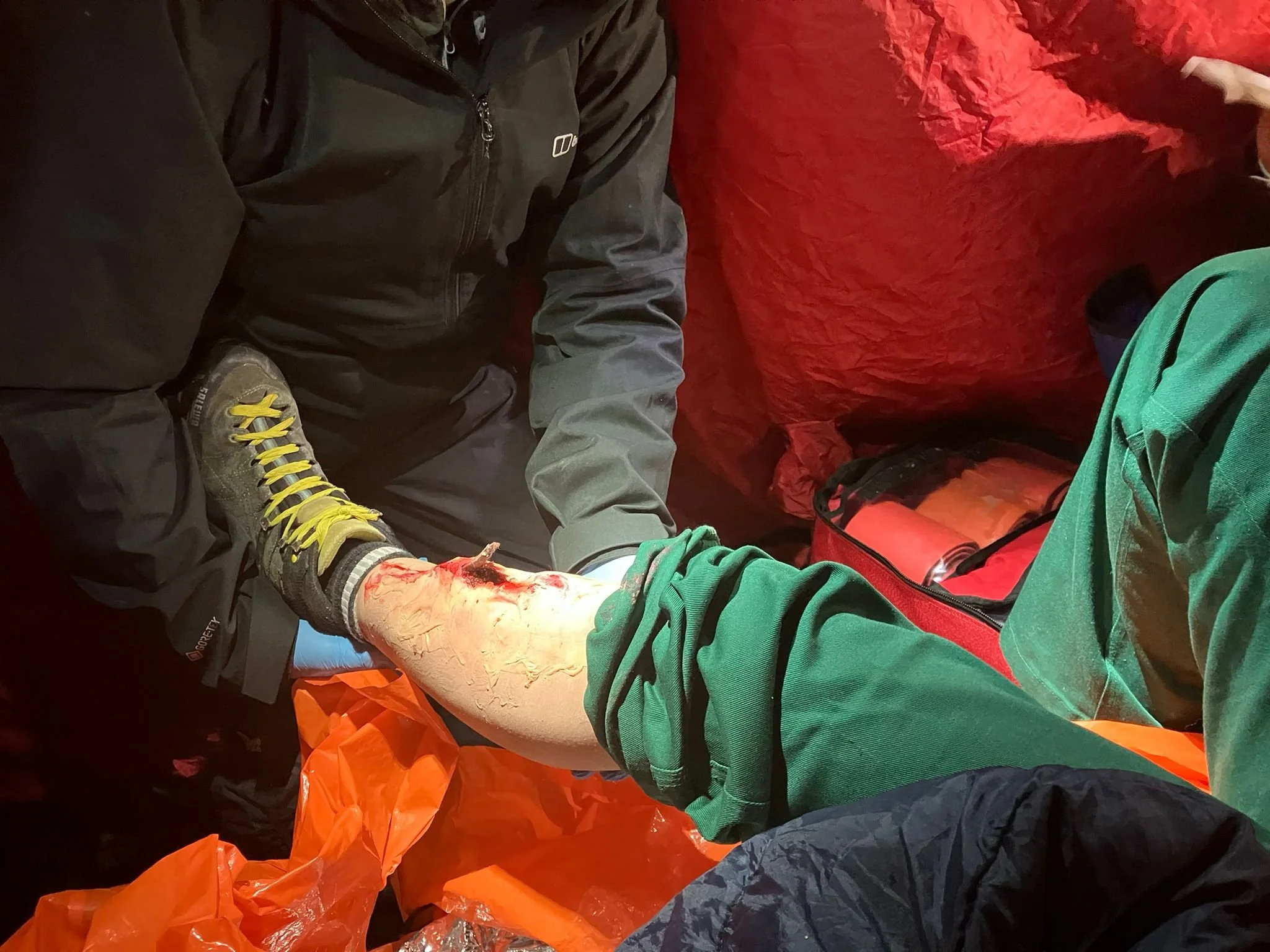 A person with a bloodied scraped leg sitting inside a tent or shelter, with another person attending to the injury, surrounded by red and orange supplies.