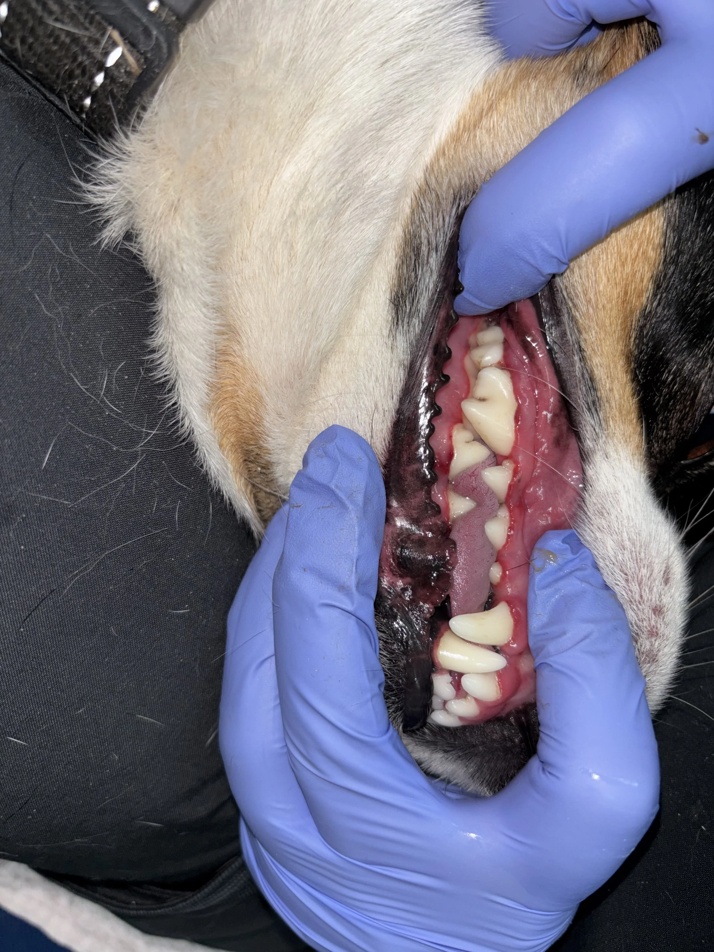 Teeth Cleaning