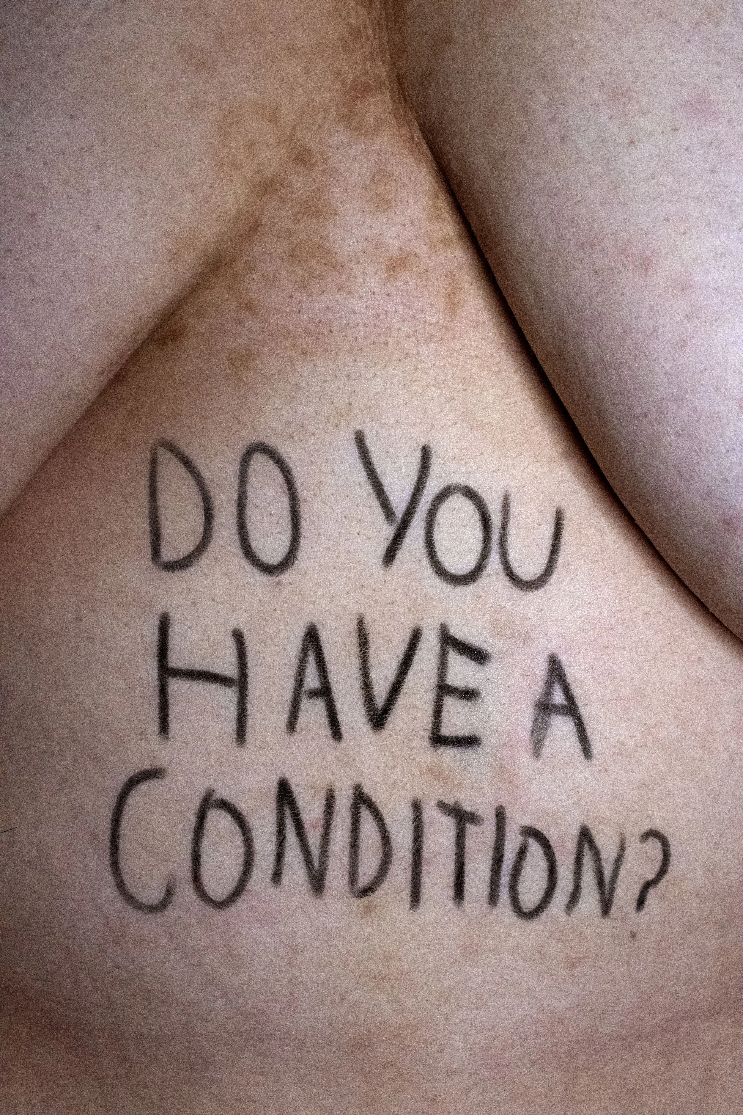 condition .jpg