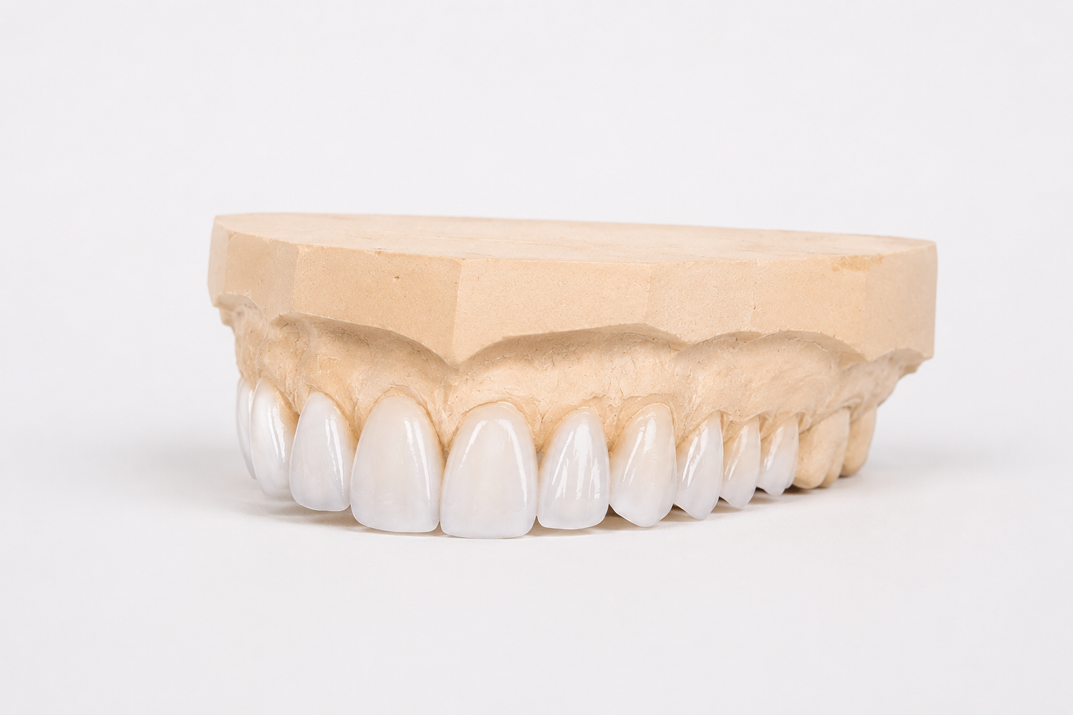 A dental model of upper teeth with a custom-made dental crown on a beige dental cast.