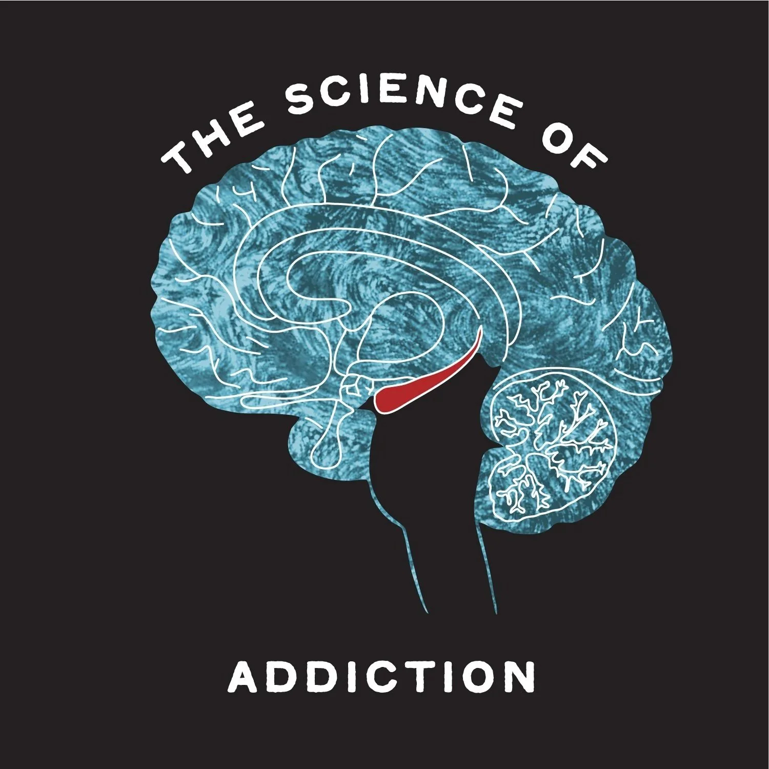 The Science of Addiction Recovery: How Sober Living Supports Lasting Sobriety