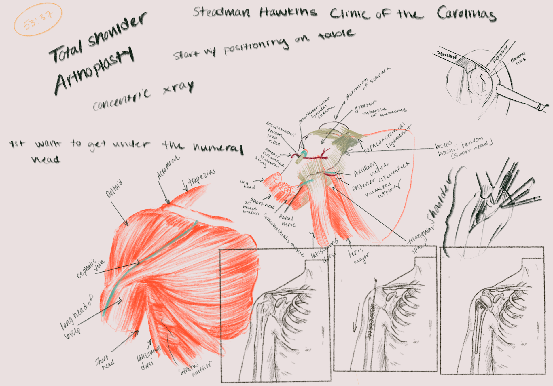 Surgical Observation Notes - Procreate - 2021