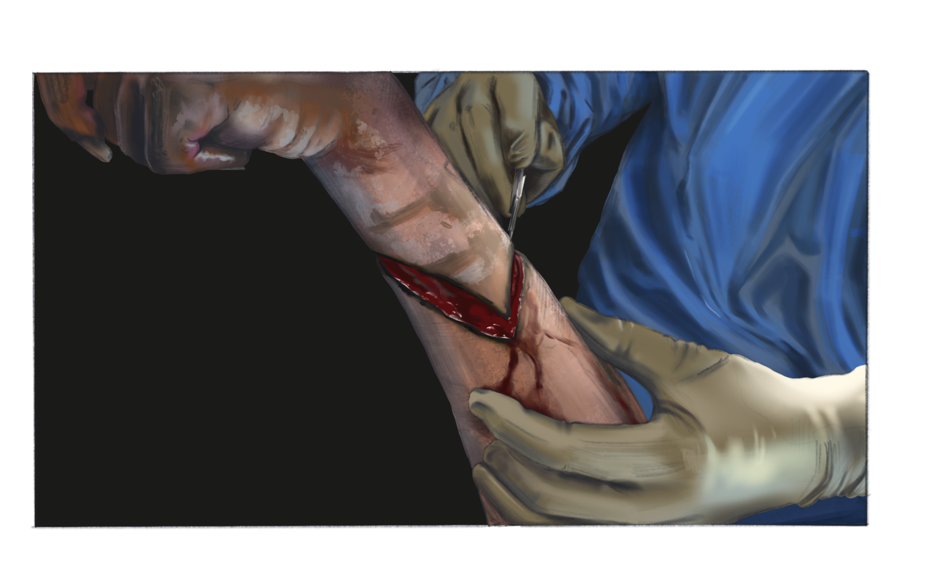Surgical Observation Study - Procreate - 2021