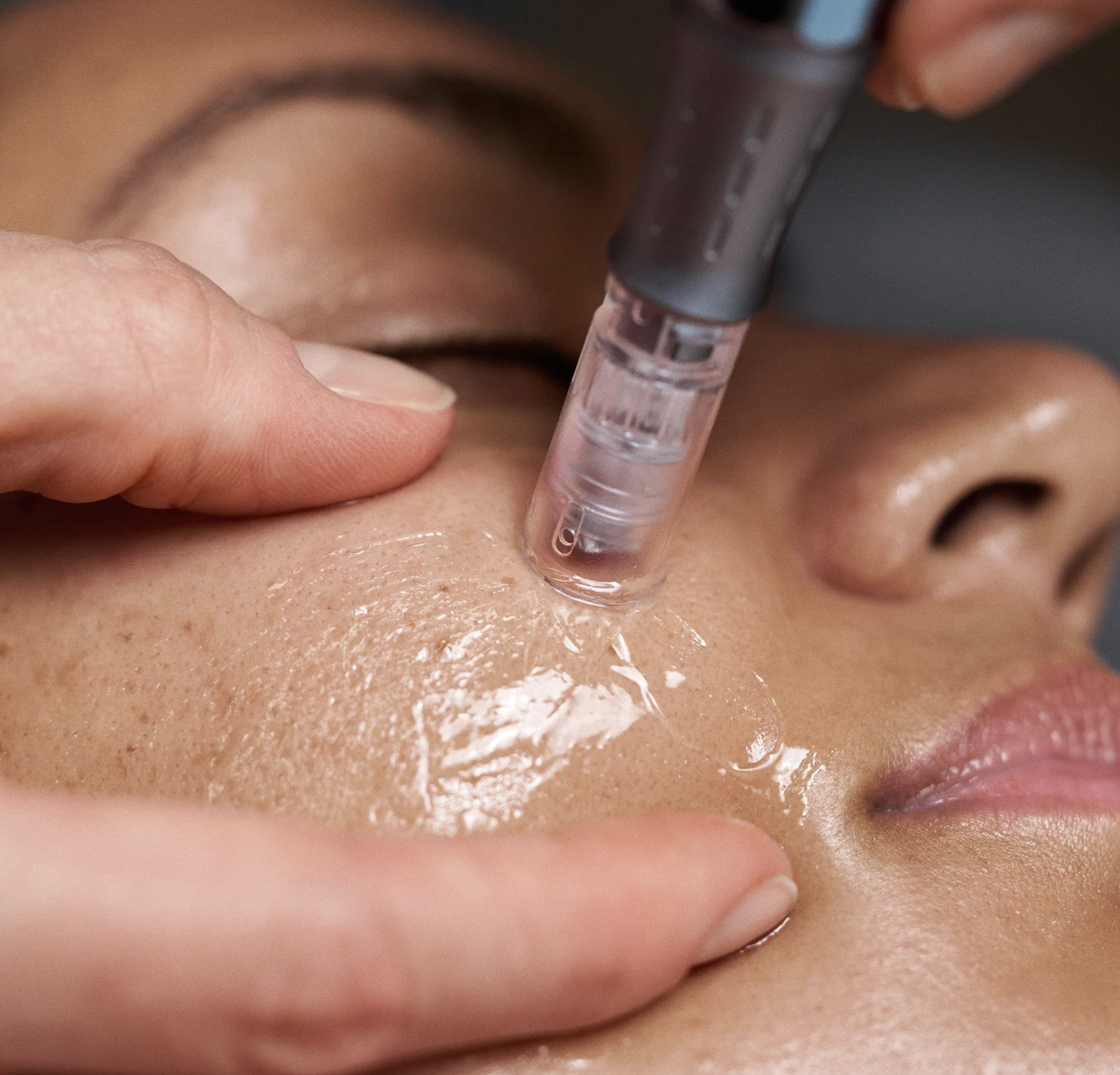 Nanofusion treatment