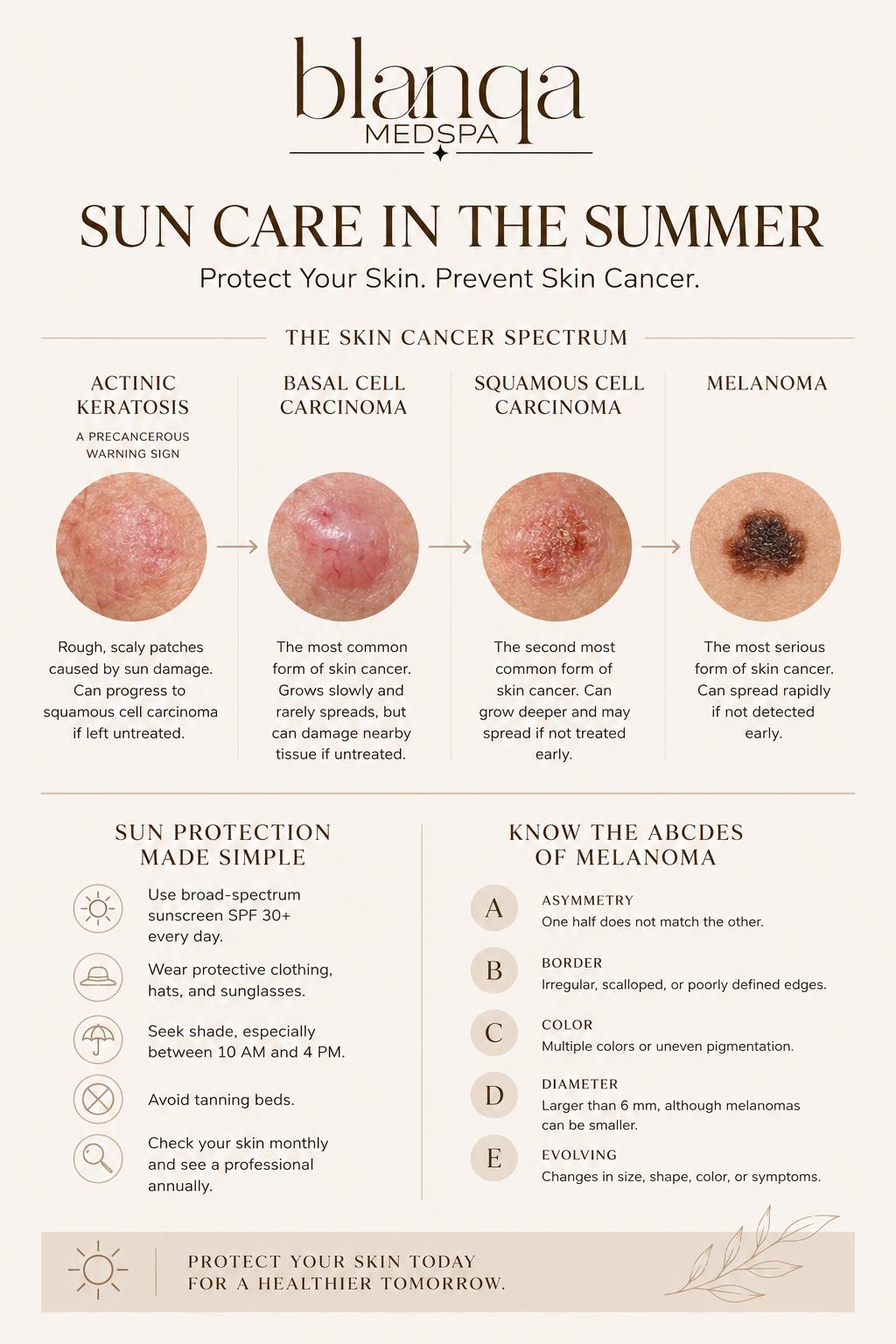 Summer Sun Safety: Protecting Your Skin from Skin Cancer