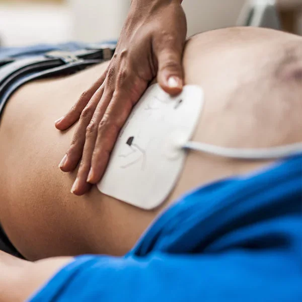 Une personne reçoit une défibrillation sur le thorax dans un cadre médical.