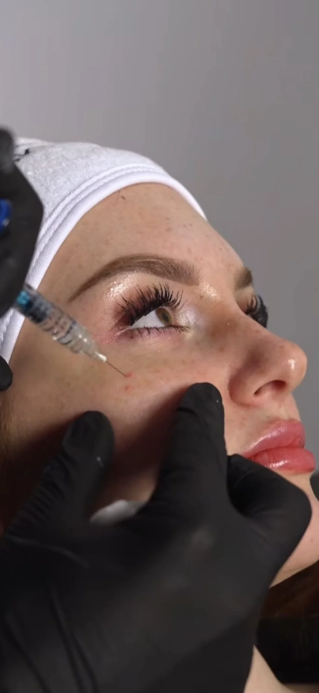 Trattamento estetico al viso eseguito in studio professionale.