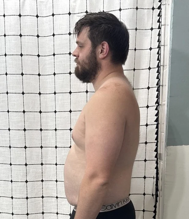 Side view of a clients pre-transformation about to start his training program