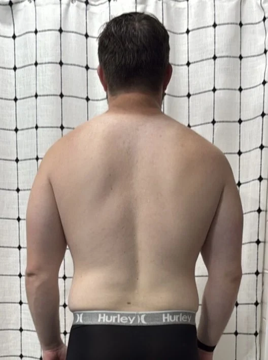 Back view of a client pre-transformation about to start his training program