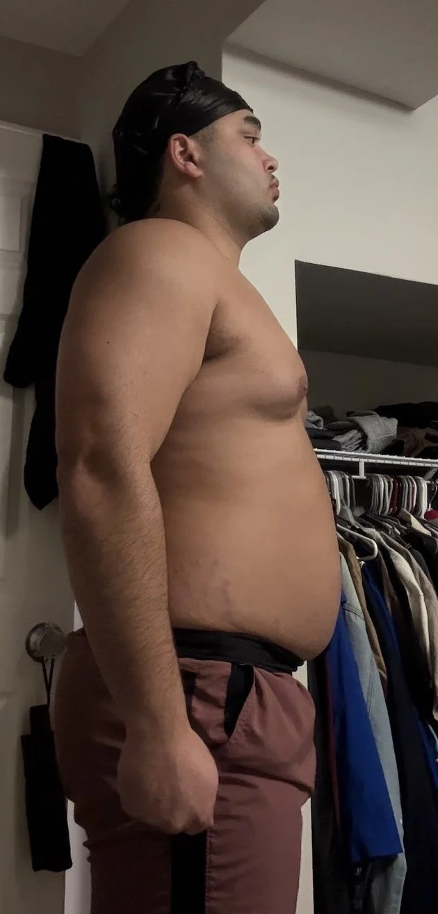 Side view of clients pre-transformation
