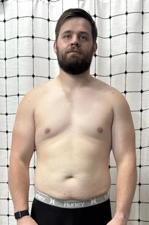 Front view of a clients pre-transformation about to start his training program
