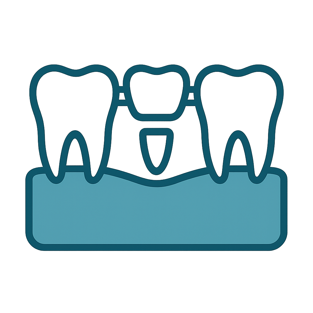 Dental Bridge using pontics
