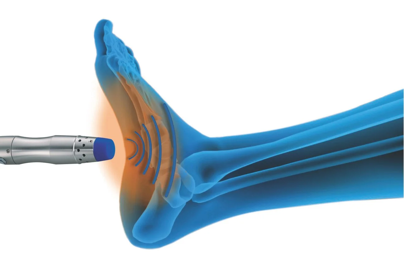 Digital illustration of a medical device emitting ultrasound waves towards a human heel, highlighting the bones and soft tissues in blue and orange tones.