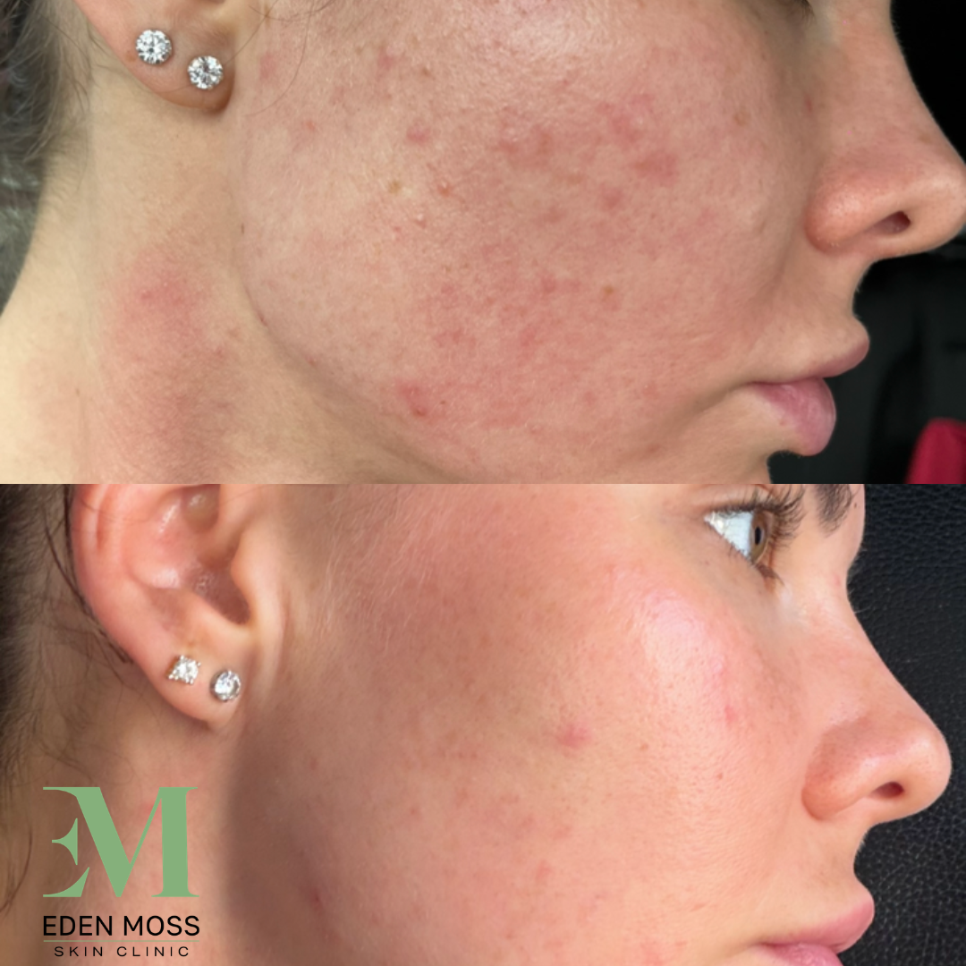 B&A (3).png