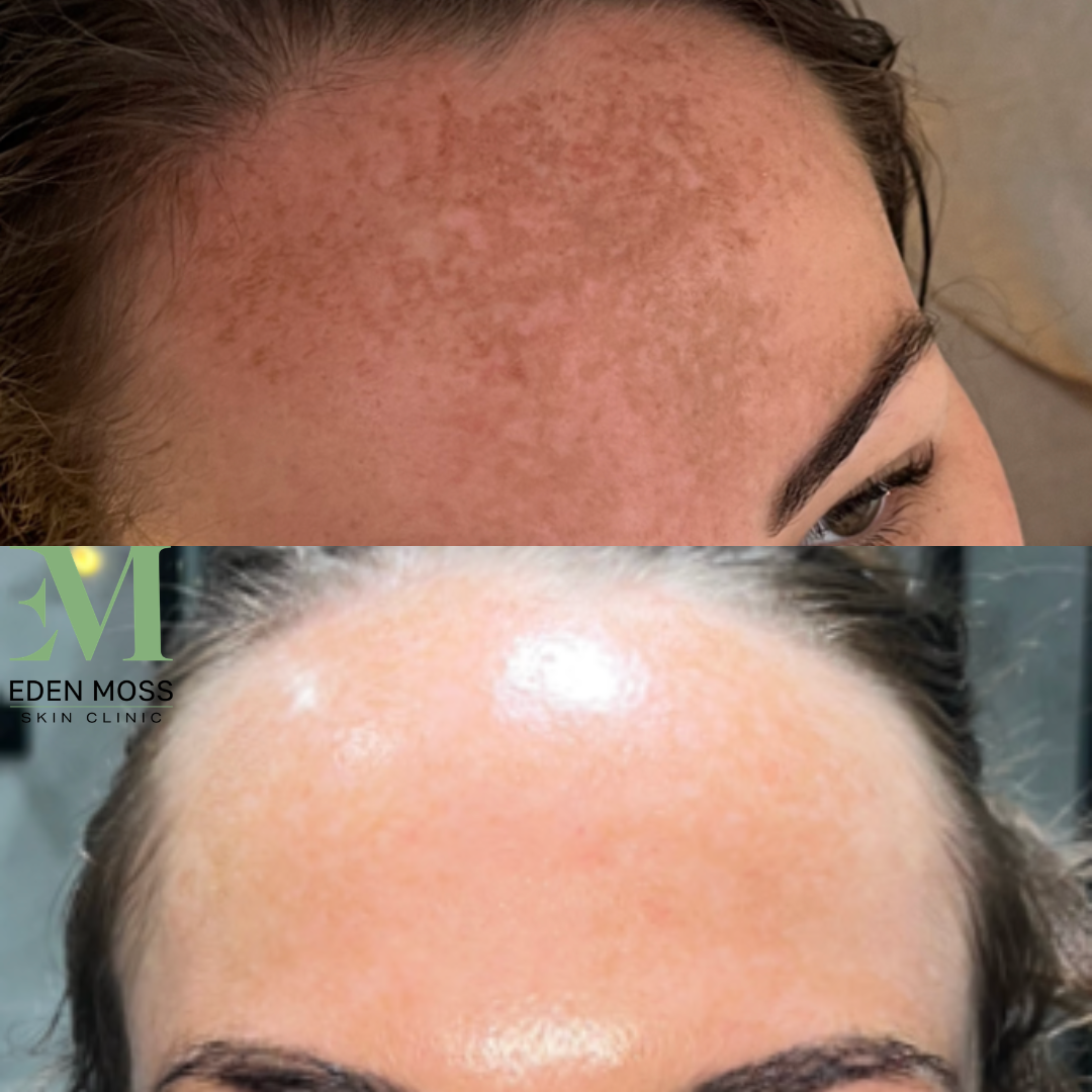B&A (2).png