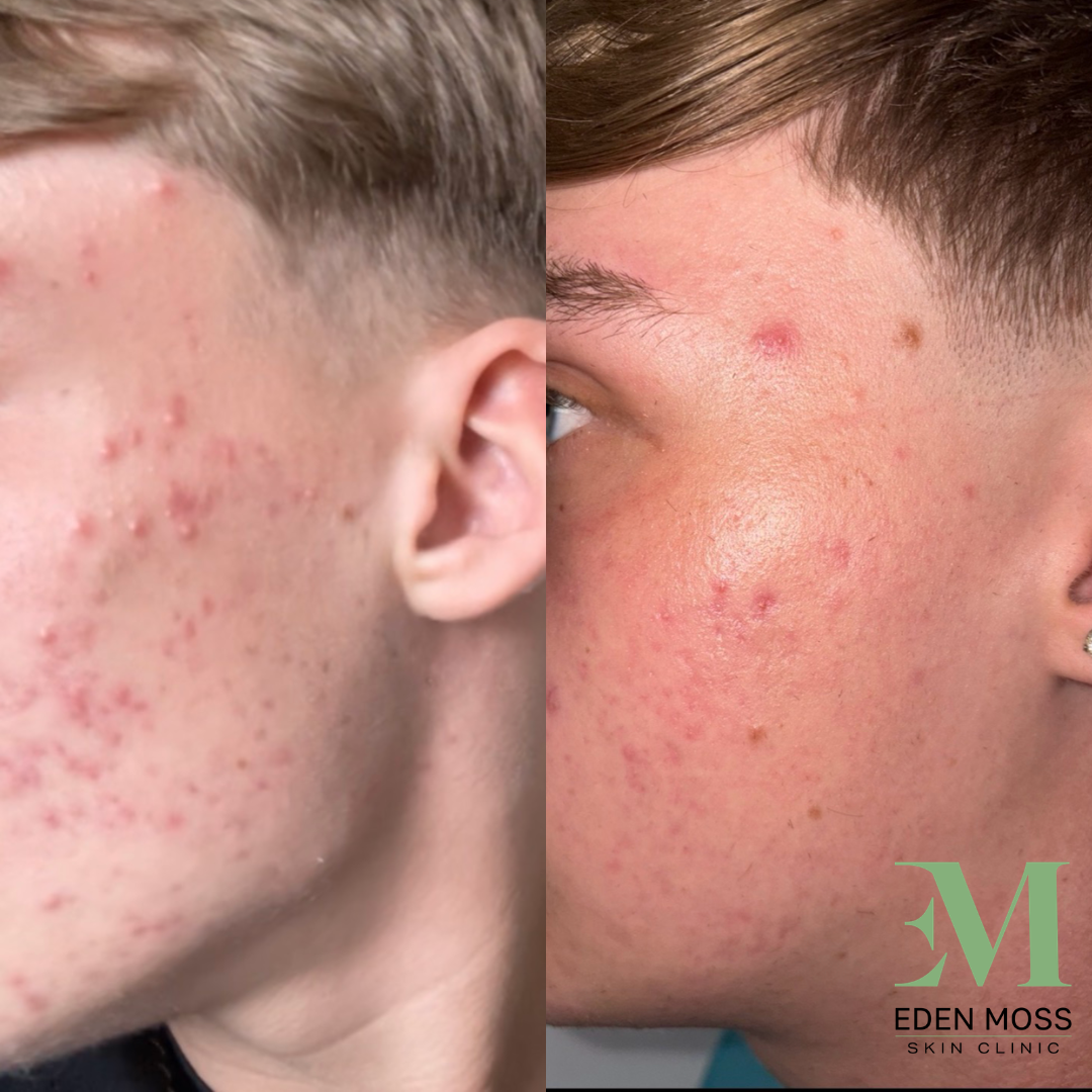 B&A (1).png