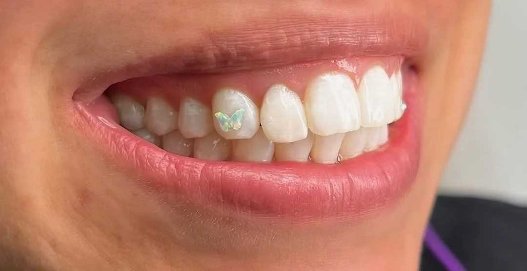 Close-up of a person's smile with a small, iridescent butterfly-shaped sticker on one of the front teeth.