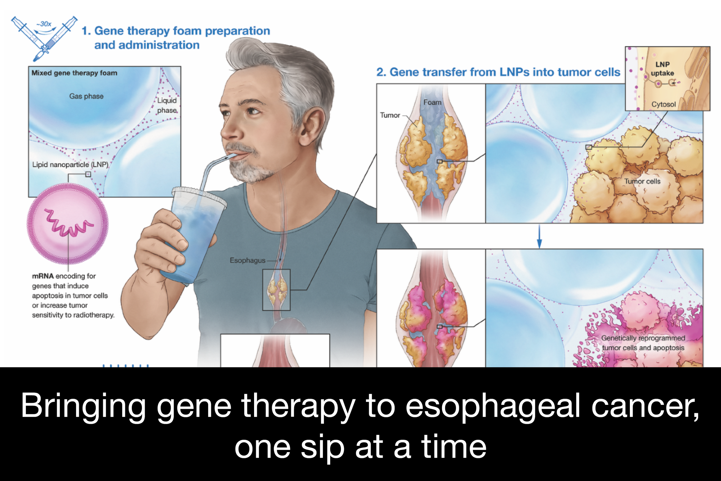 genetherapyfoam.png
