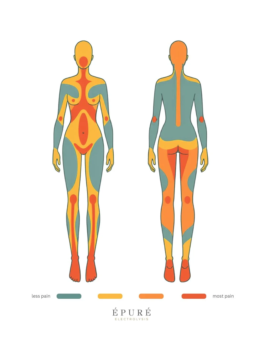 Diagram of a woman's body showing areas of pain, with red marking the most pain, orange for more pain, yellow for less pain, and green for least pain.