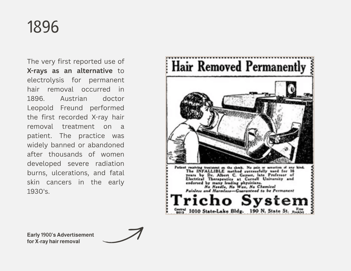 Early 1900s black and white advertisement for X-ray hair removal showing a woman receiving treatment with a large machine labeled 'Hair Removed Permanently' and the text emphasizing the painlessness and permanence of the treatment.