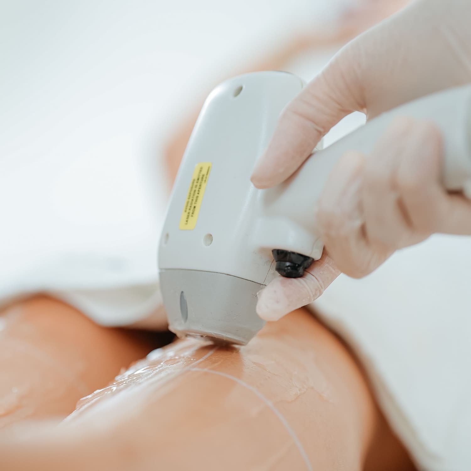 Close-up of a healthcare professional's hand administering an injection on a patient's arm.