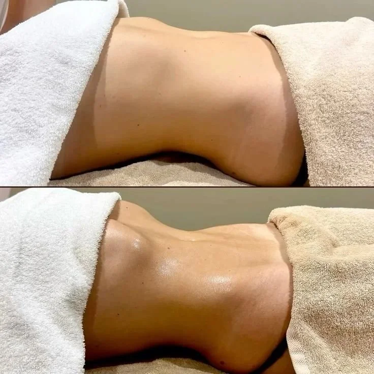 Side-by-side images of a person's back during a massage, showing a before and after comparison with the skin appearing more relaxed and shiny in the after photo.