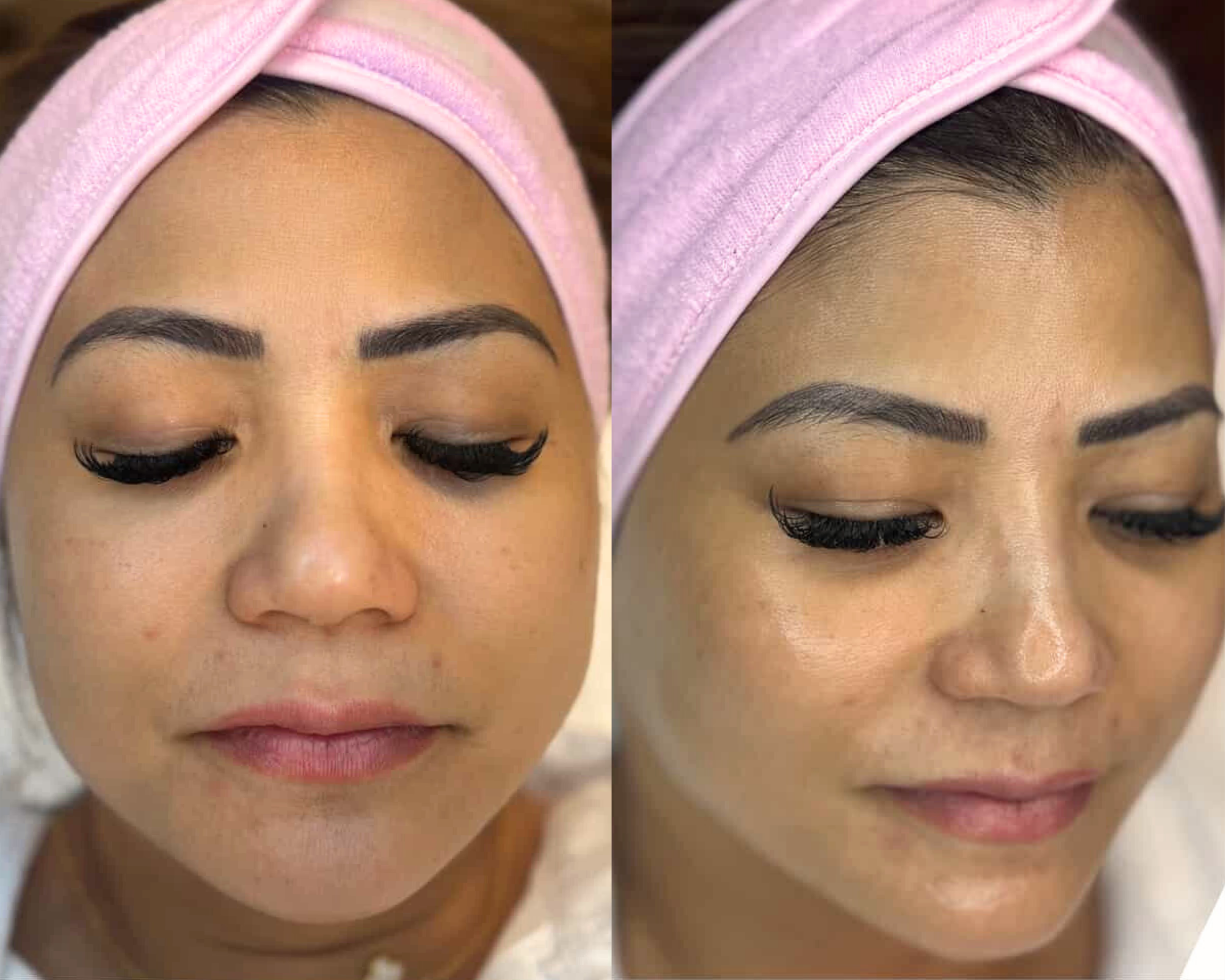 Before-and-after comparison of a client's facial skin tone and texture in a pink spa headband at Glow in Grace Aesthetics.