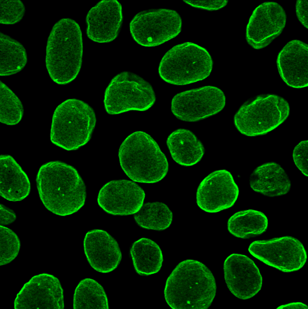 Human HCT-116 cell nuclei immunostained for lamin A/C intermediate filaments.