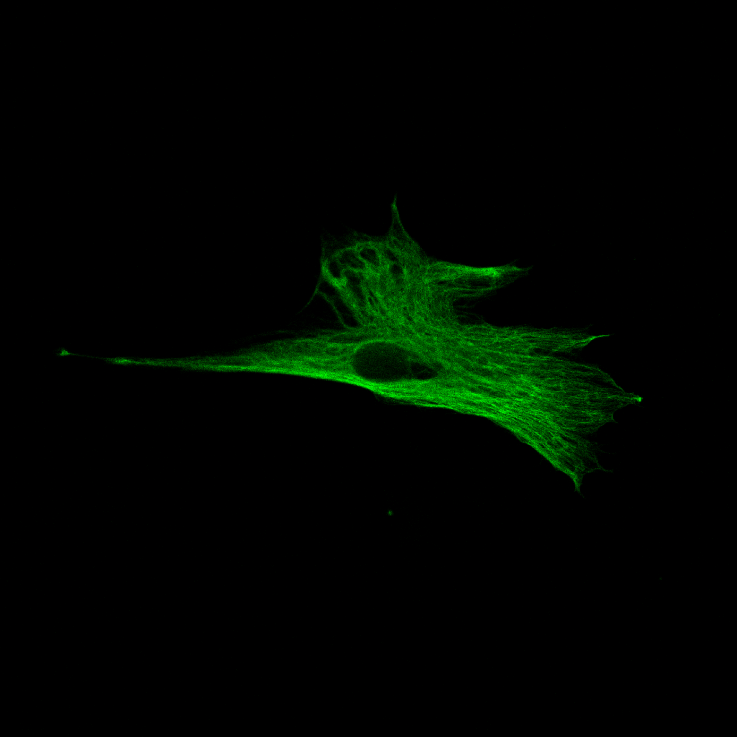 Vimentin intermediate filaments form a network in Schlemm's canal endothelial cells.