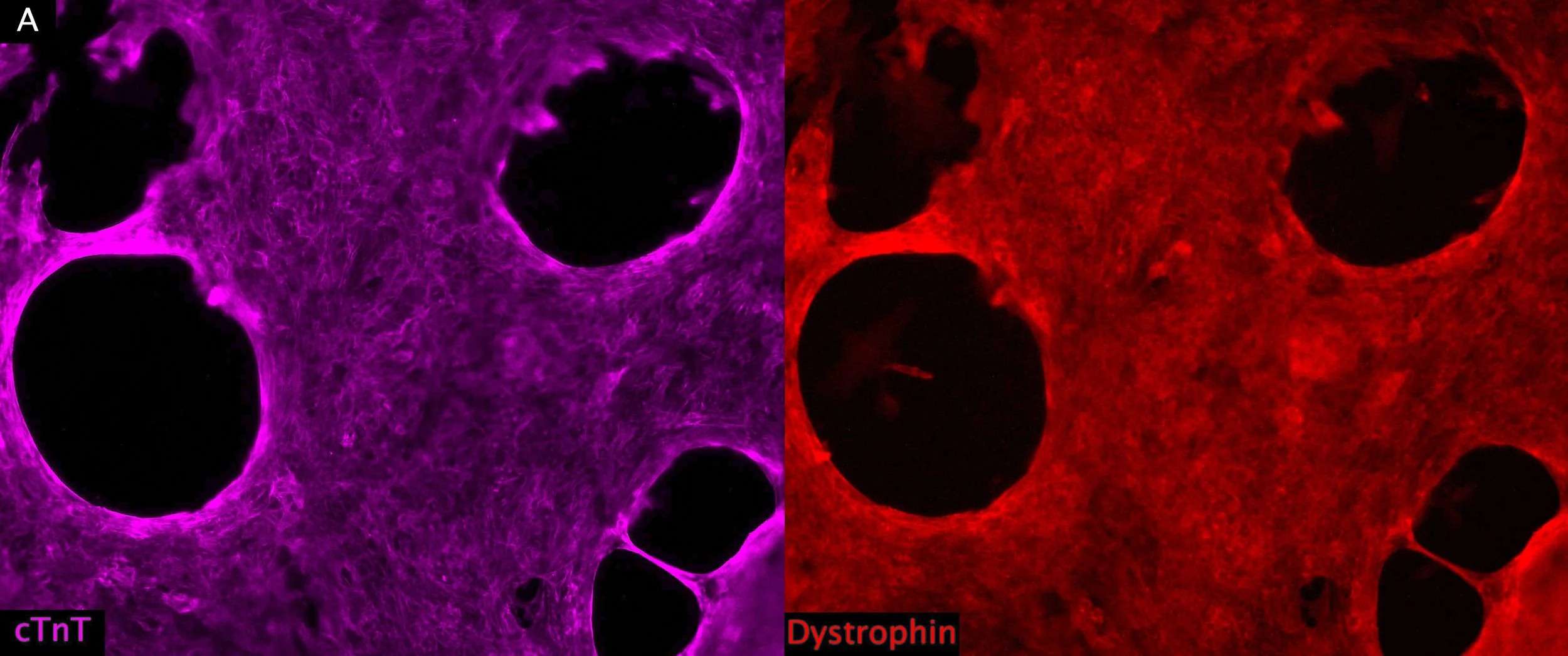 Human iPSC-derived cardiomyocyte sheet for cardiac regeneration and disease modeling.  