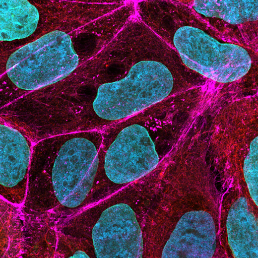 Human DLD-1 cells immunostained for F-actin, Keratin intermediate filaments, and DAPI. 