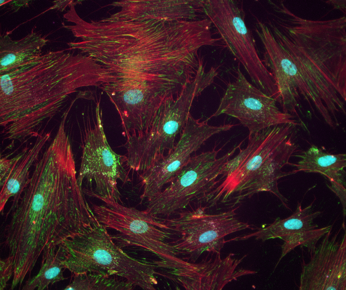 Schlemm’s canal endothelial cells imunostained for alpha5 integrins, F-actin, and DAPI. 