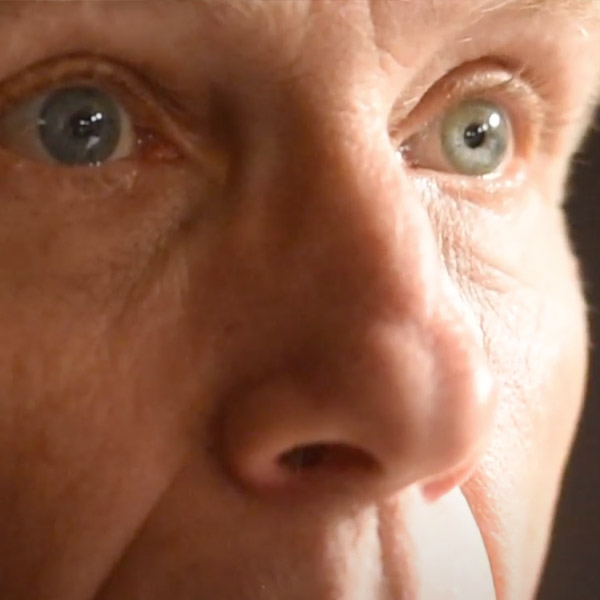 Close-up of a person's face, focusing on eyes, nose, and surrounding skin.