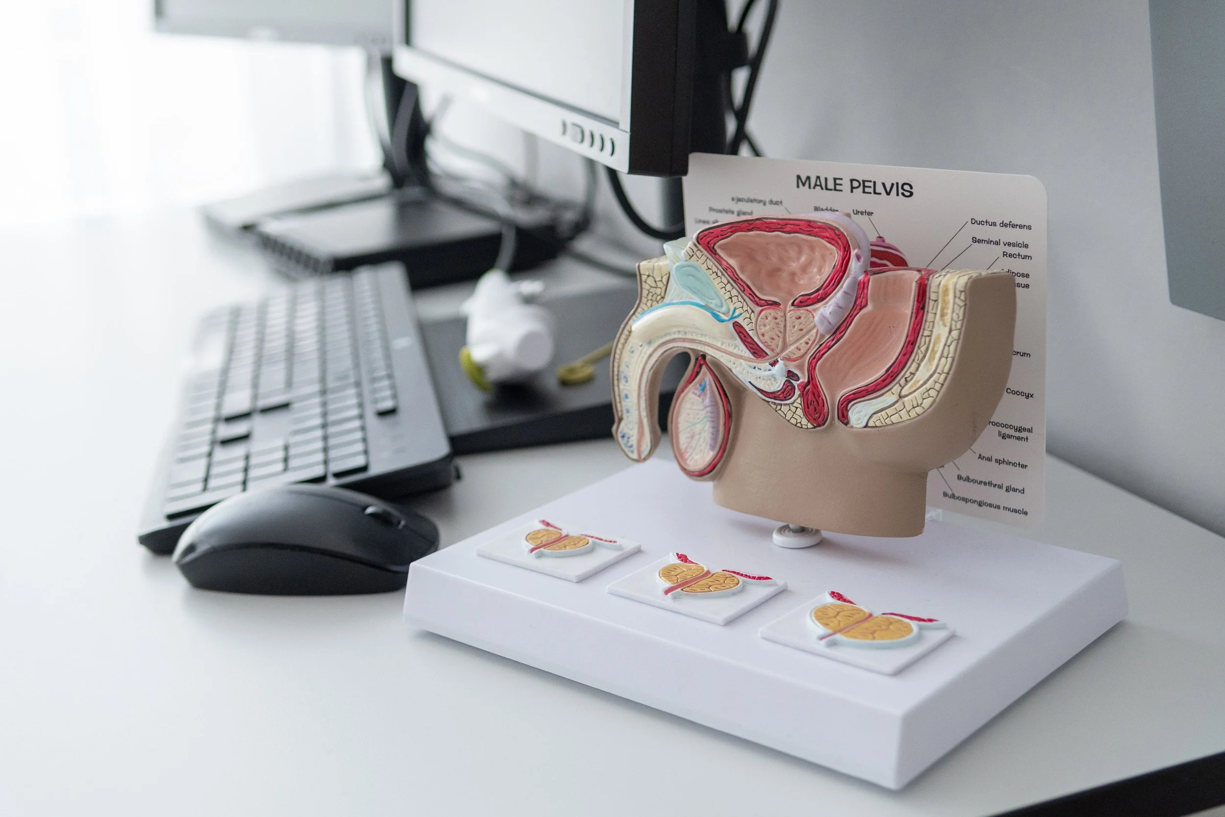 Ein anatomisches Modell des männlichen Beckens und der Geschlechtsorgane, mit Beschriftungen, auf einem Schreibtisch in einem Büro, neben einem schwarzen Computer-Monitor, einer Tastatur und einer Maus.