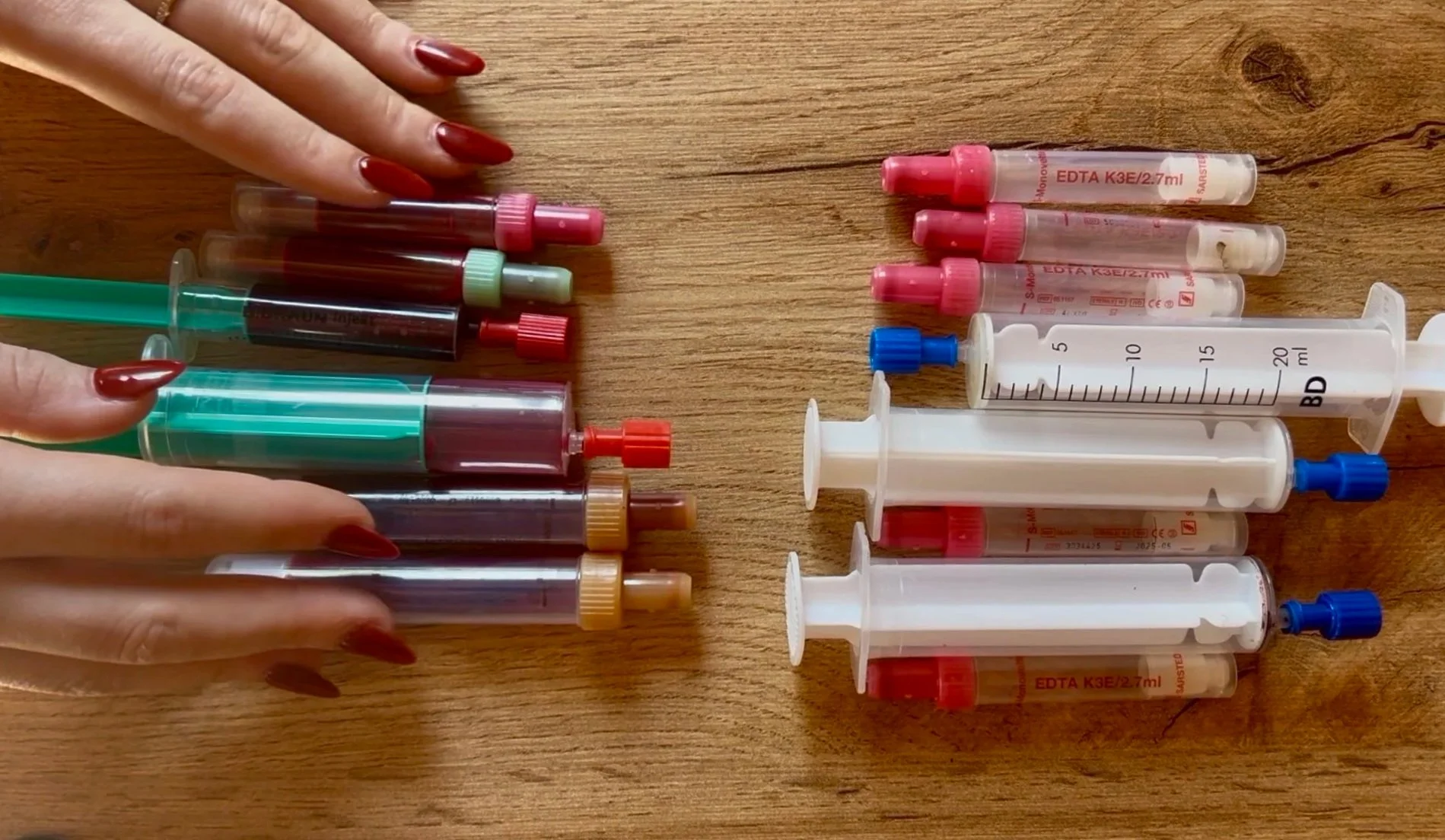 Several syringes filled with blood and medical tubes on a wooden surface, with a person's hand with painted red nails on the left side.