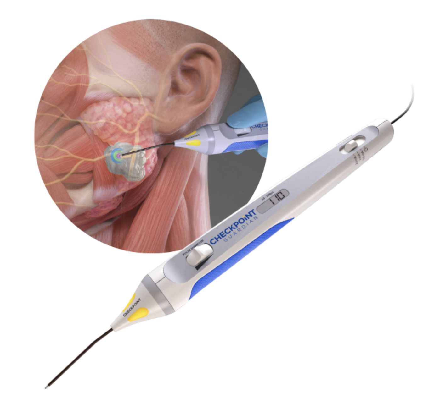 Checkpoint Surgical