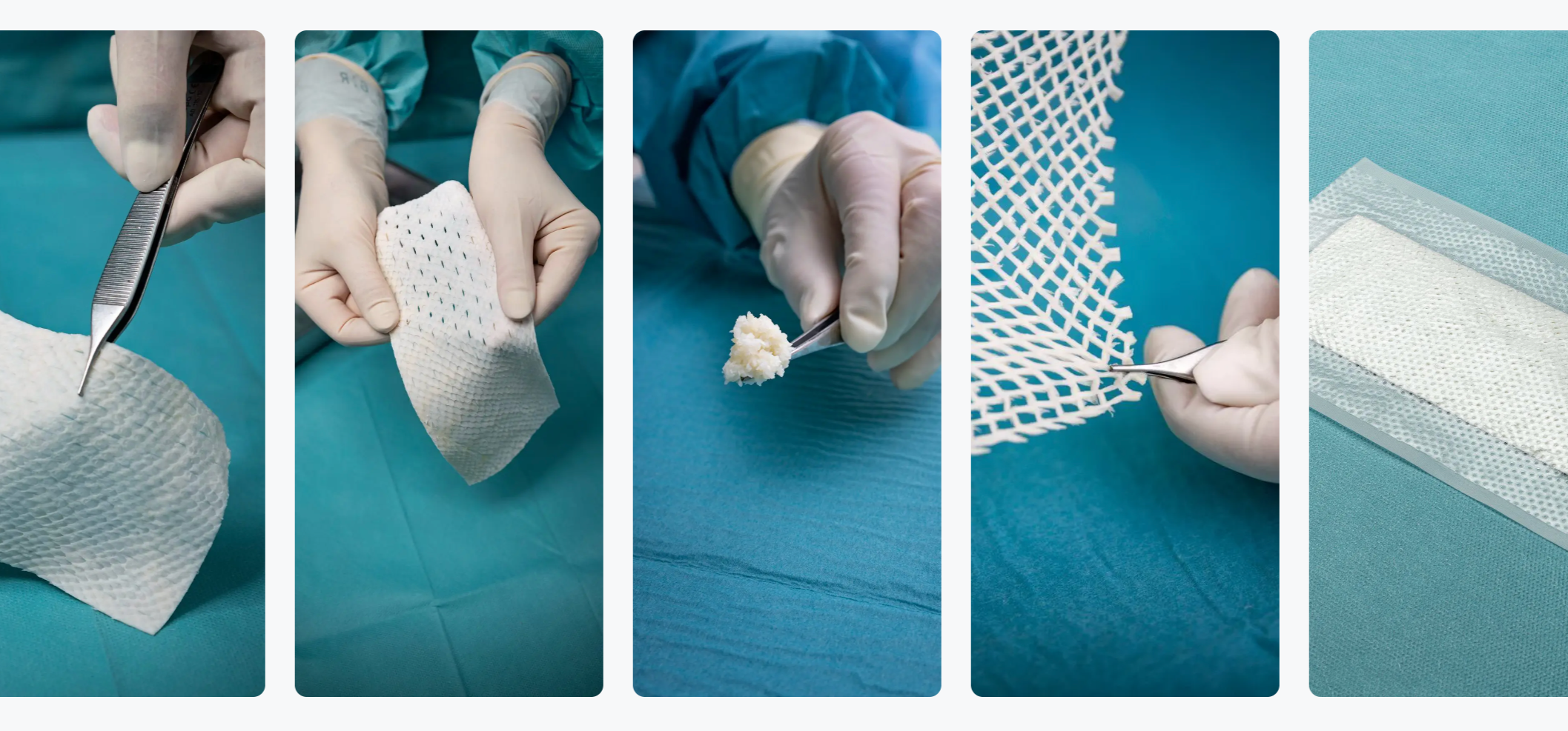 Sequence of five images showing medical professionals using surgical tools and mesh for a procedure on a patient's leg.