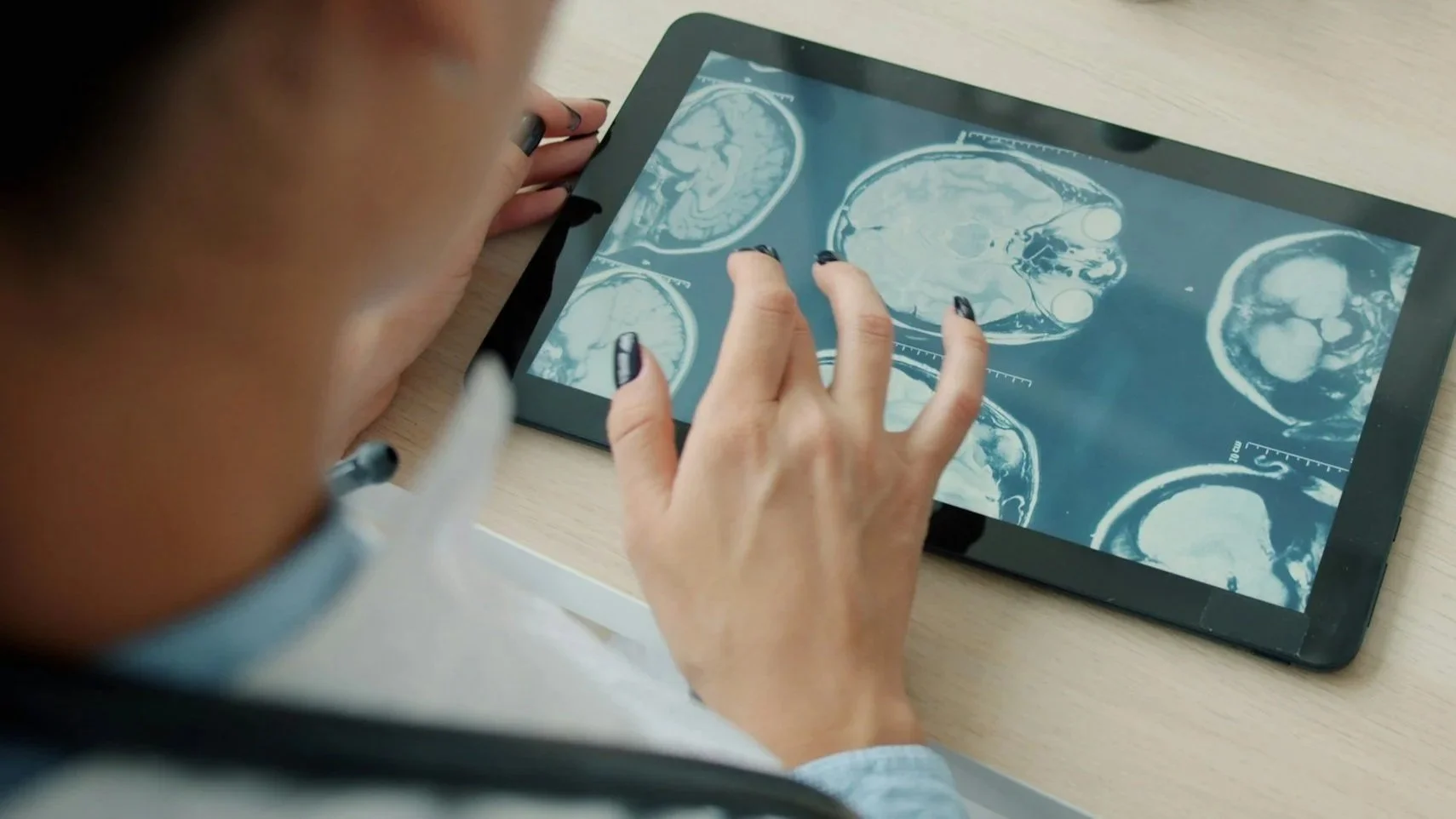Neurology provider reviewing MRI brain images for diagnosis and treatment planning.
