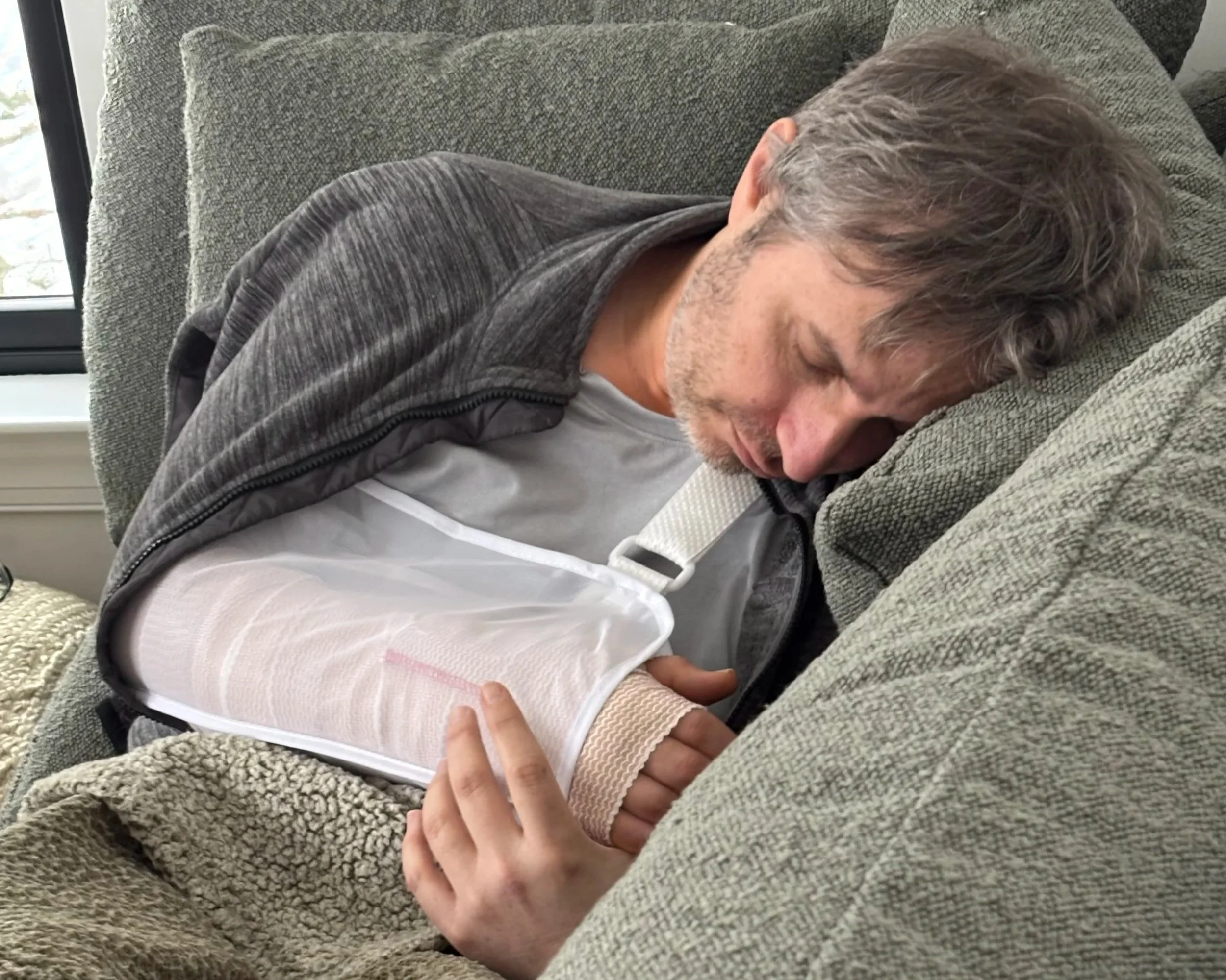 Picture of me asleep on the couch post surgery