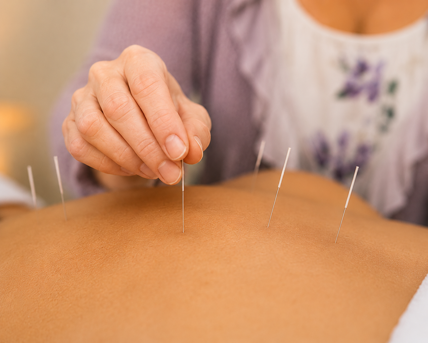 Acupuncture, Meridians, Back to Basics Wellness