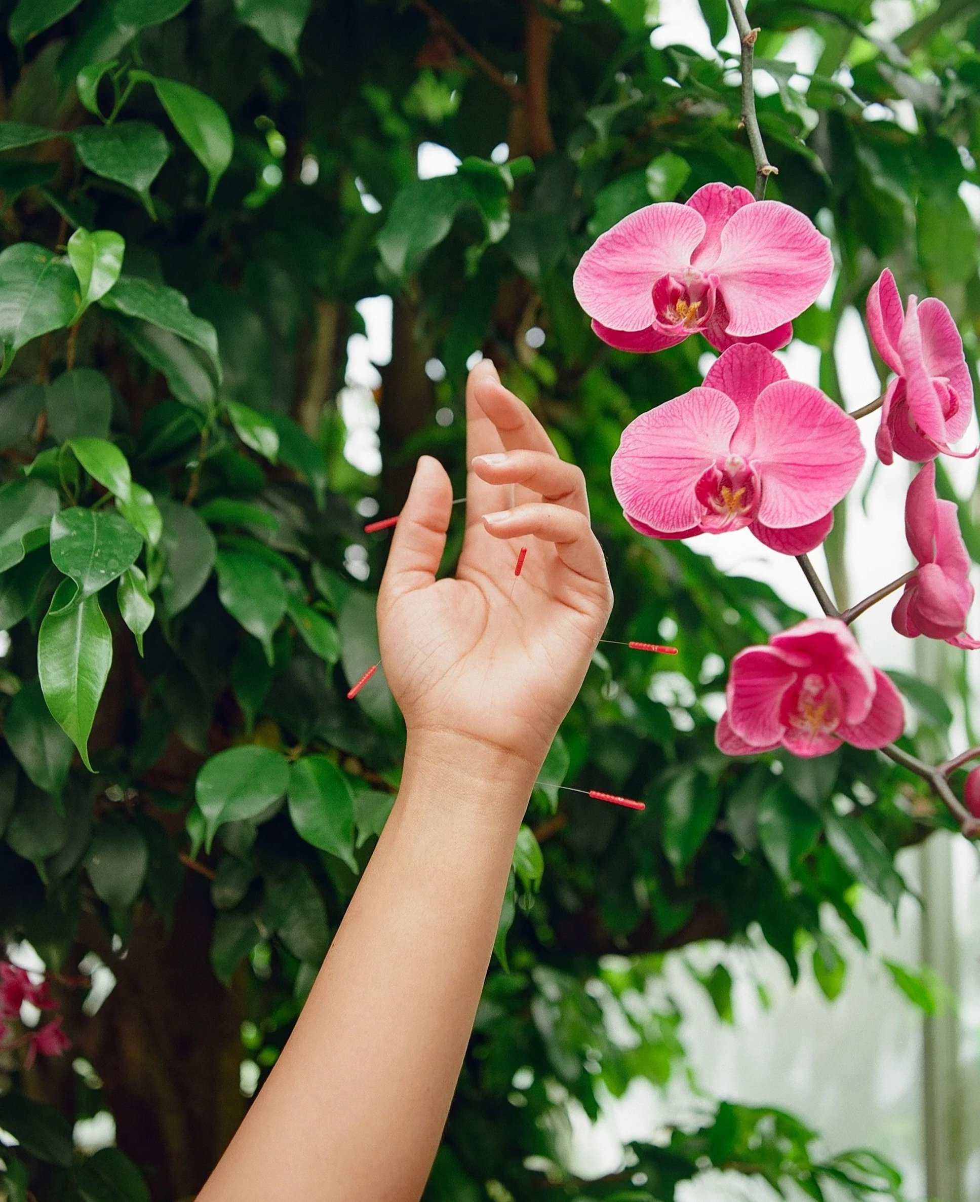 Pink orchids with falling hand with acupuncture needles and green foliage in the background.