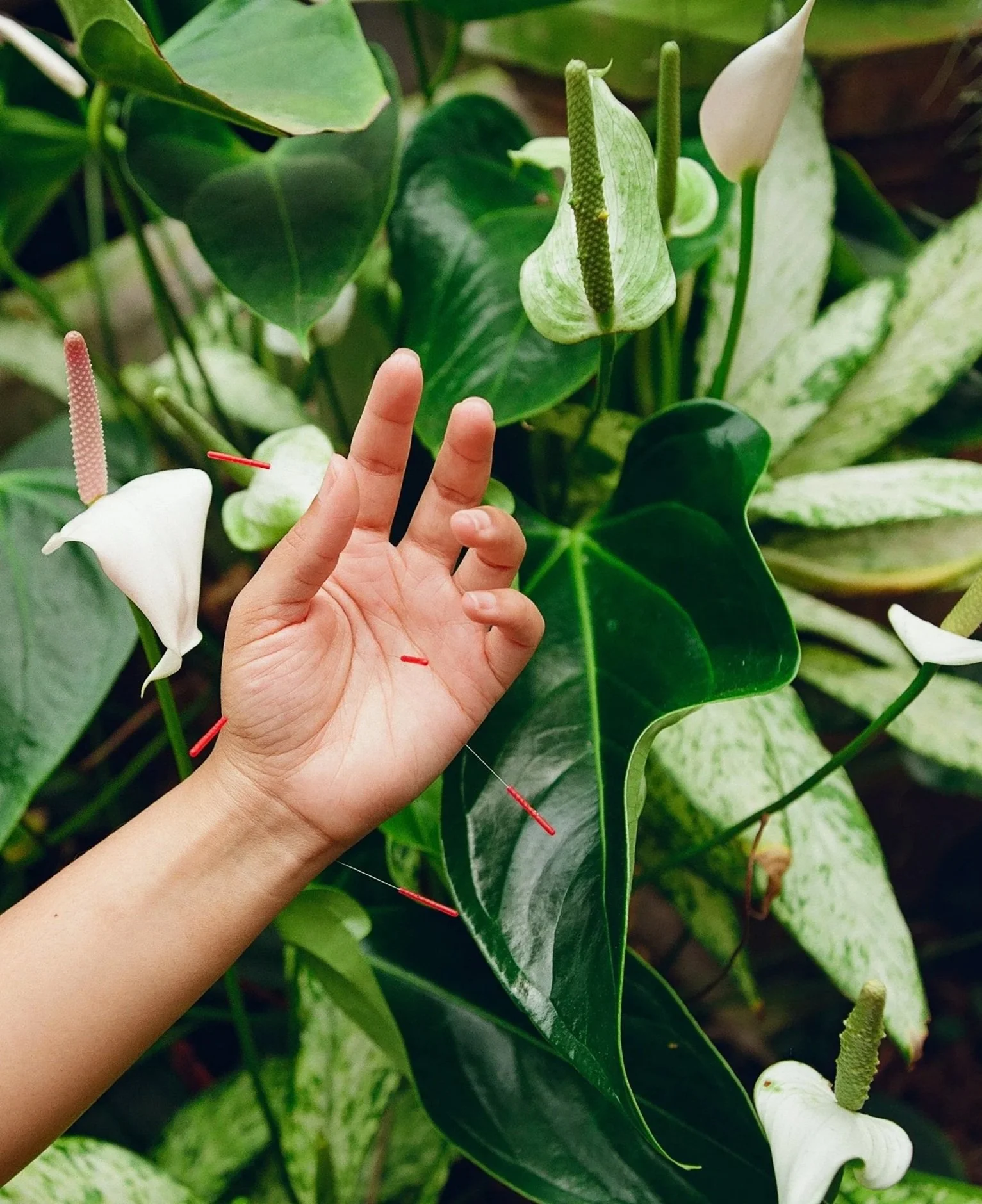 Close-up of a person's hand with acupuncture needles reaching towards a white peace lily flower with other green leafy plants in the background.