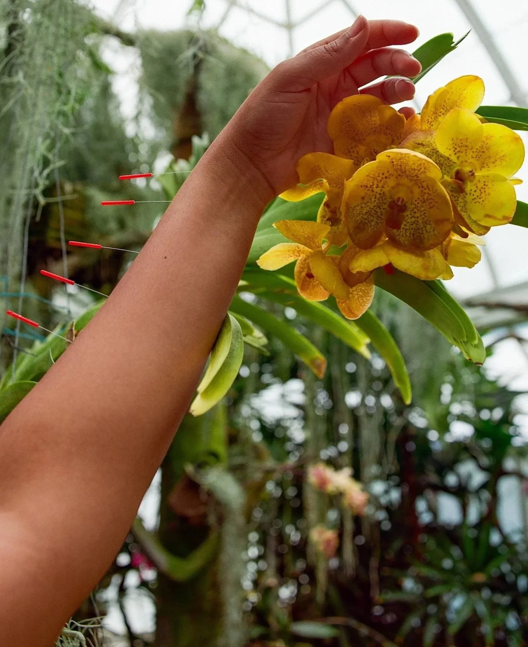 A person with acupuncture needles holding a cluster of yellow orchids with brown speckles in a greenhouse, with green leaves and bamboo in the background.