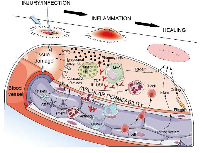 Chapter 7: Inflammation — The Silent Killer