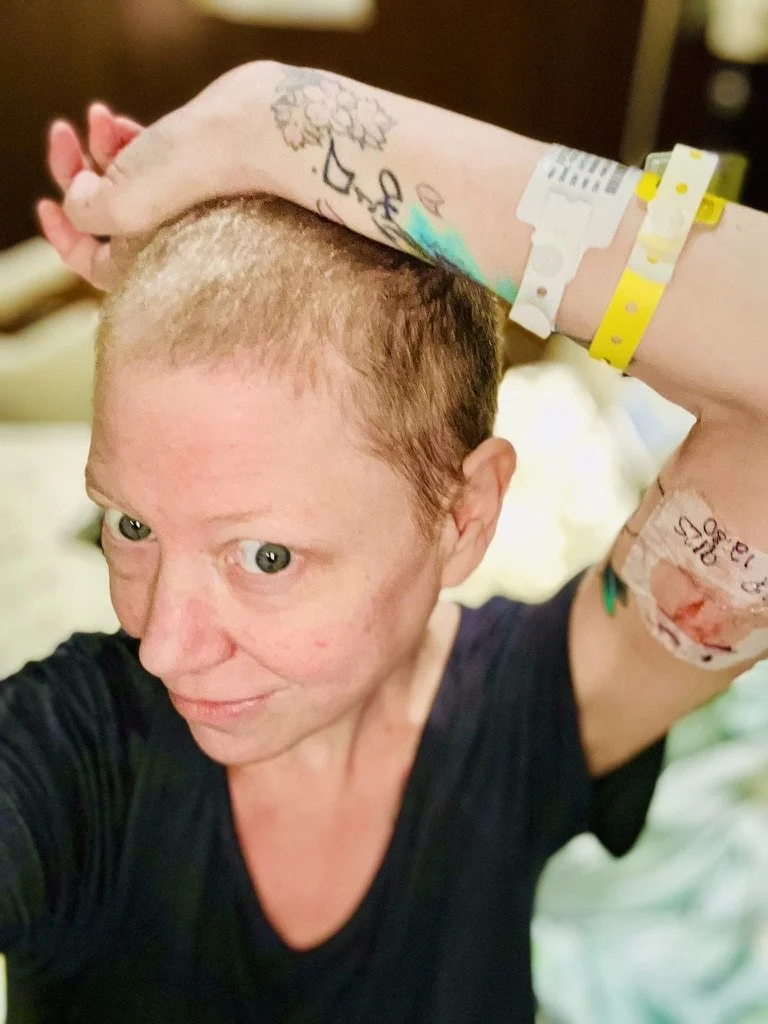Woman with closely shaved hair, wearing a black shirt, taking a selfie with a hospital wristband and tattoos on her arm.