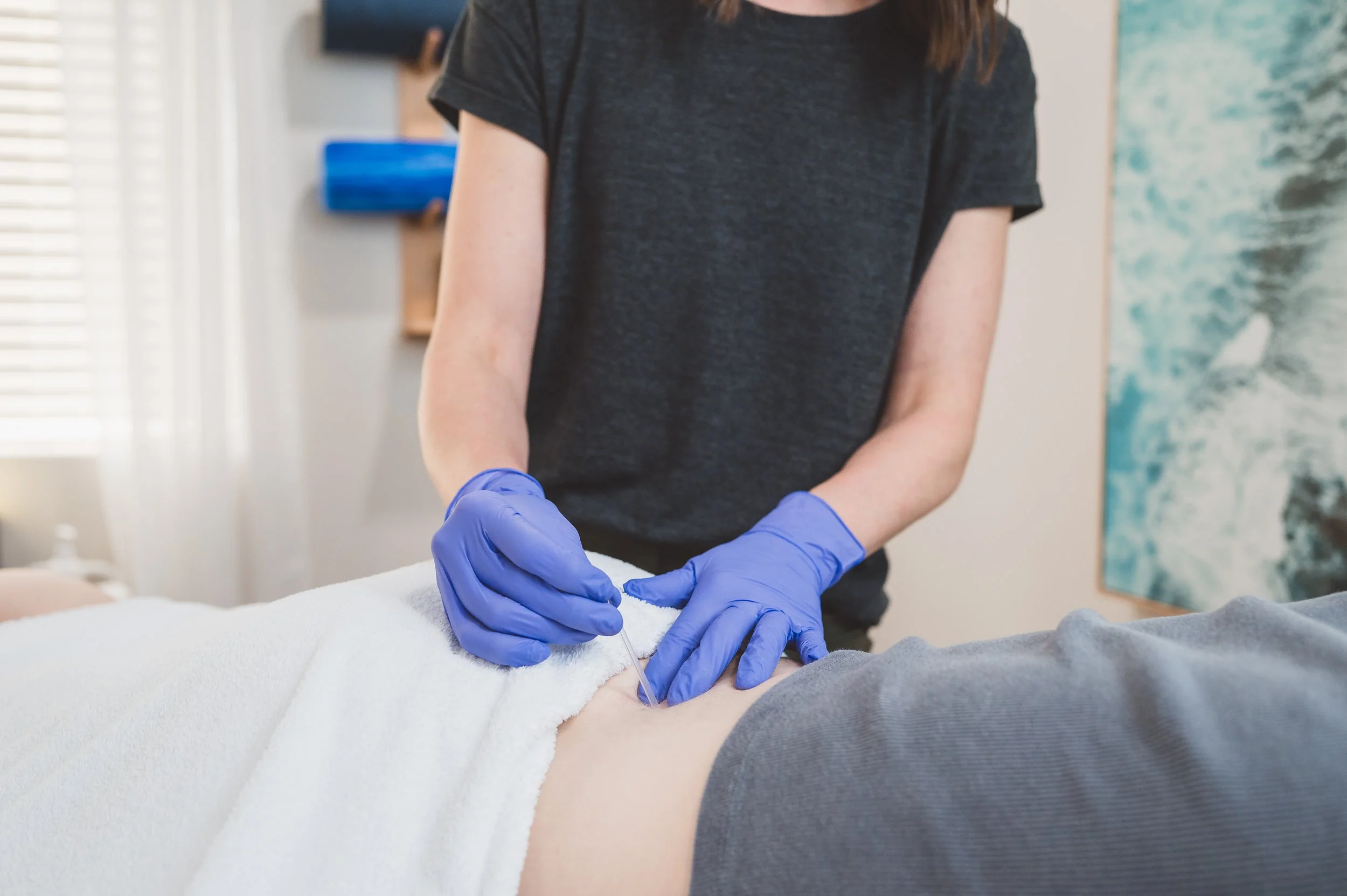 dry needling session for the low back with image demonstrating needles treating the low back