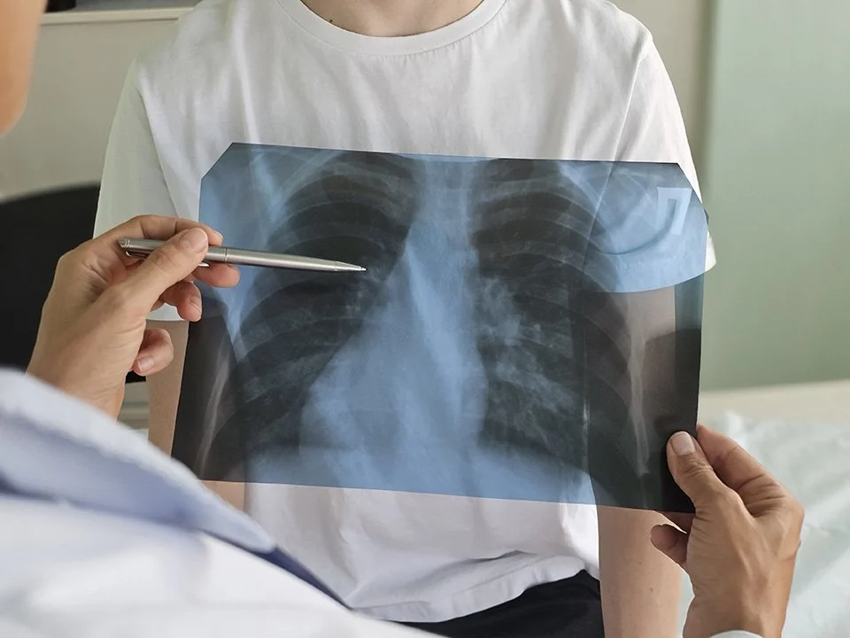 Interstitial Lung Diseases (ILD) Sleep Respiratory Physician Sydney Newcastle Little Lungs