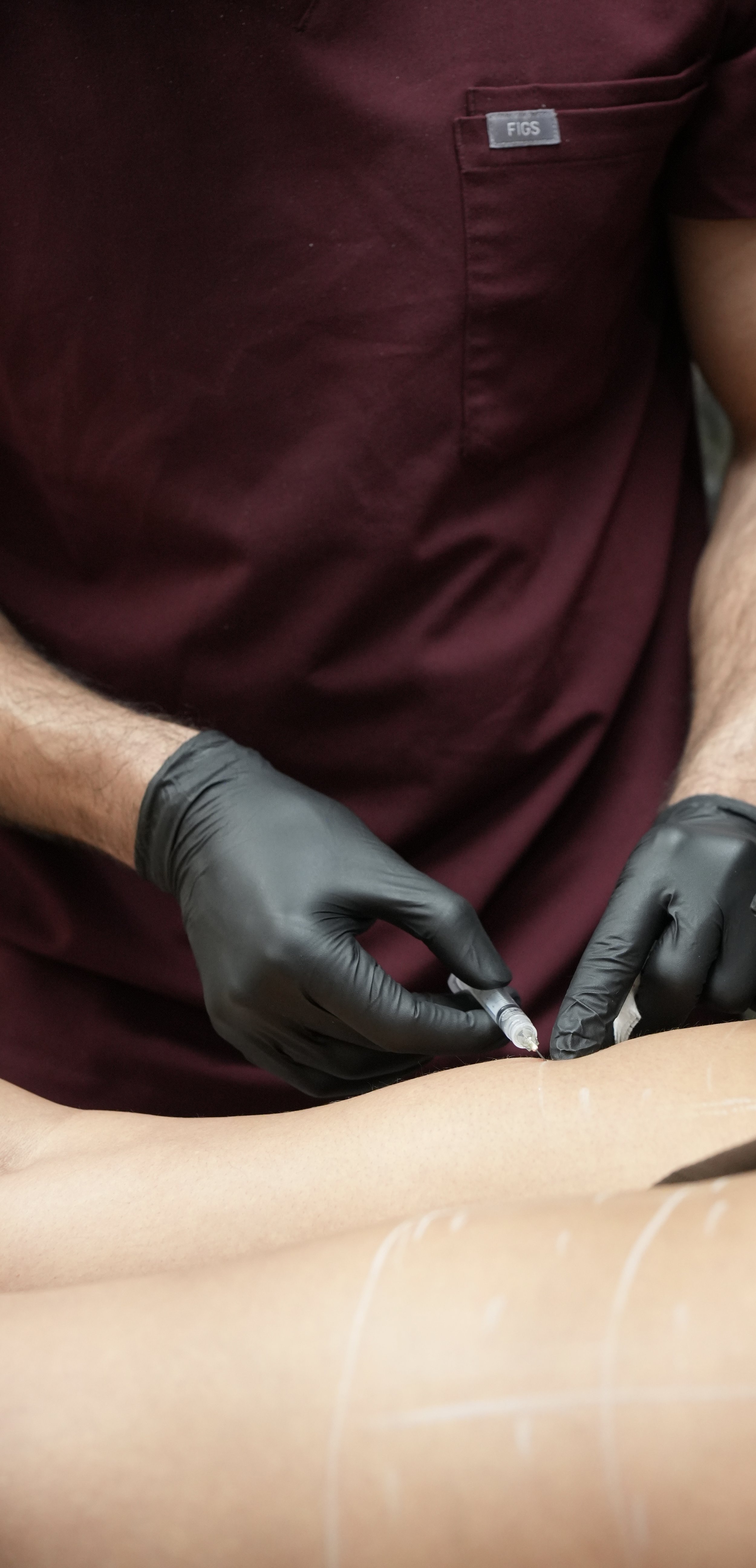 Medical professional wearing black gloves administering a tattoo or injection to a person's forearm.