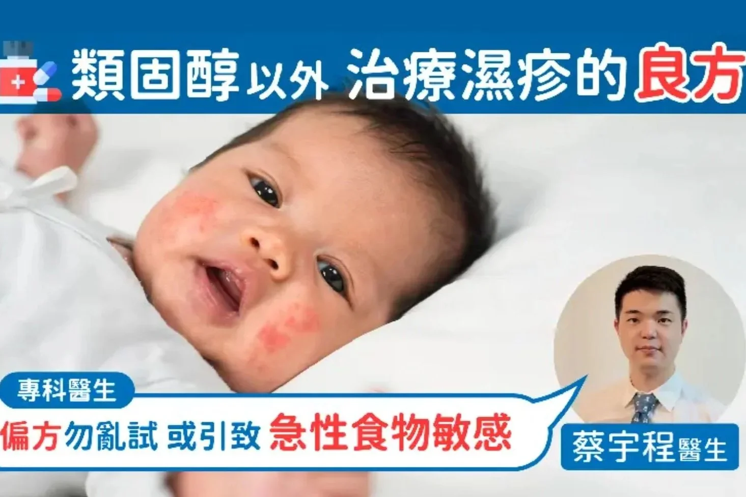 類固醇以外治療濕疹的良方 專科醫生：偏方勿亂試 或引致急性食物敏感