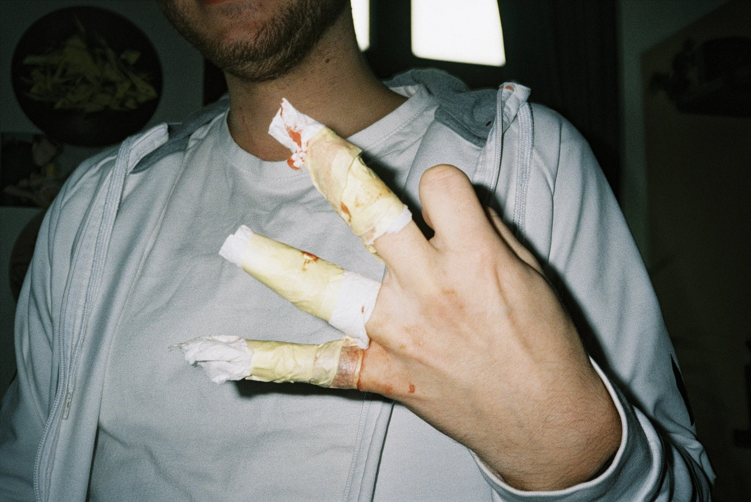 Ein Mensch mit einem Verband an der Hand, offensichtlich mit einem Gips, auf einem Tisch liegend, während eine Person den Verband betrachtet oder behandelt.